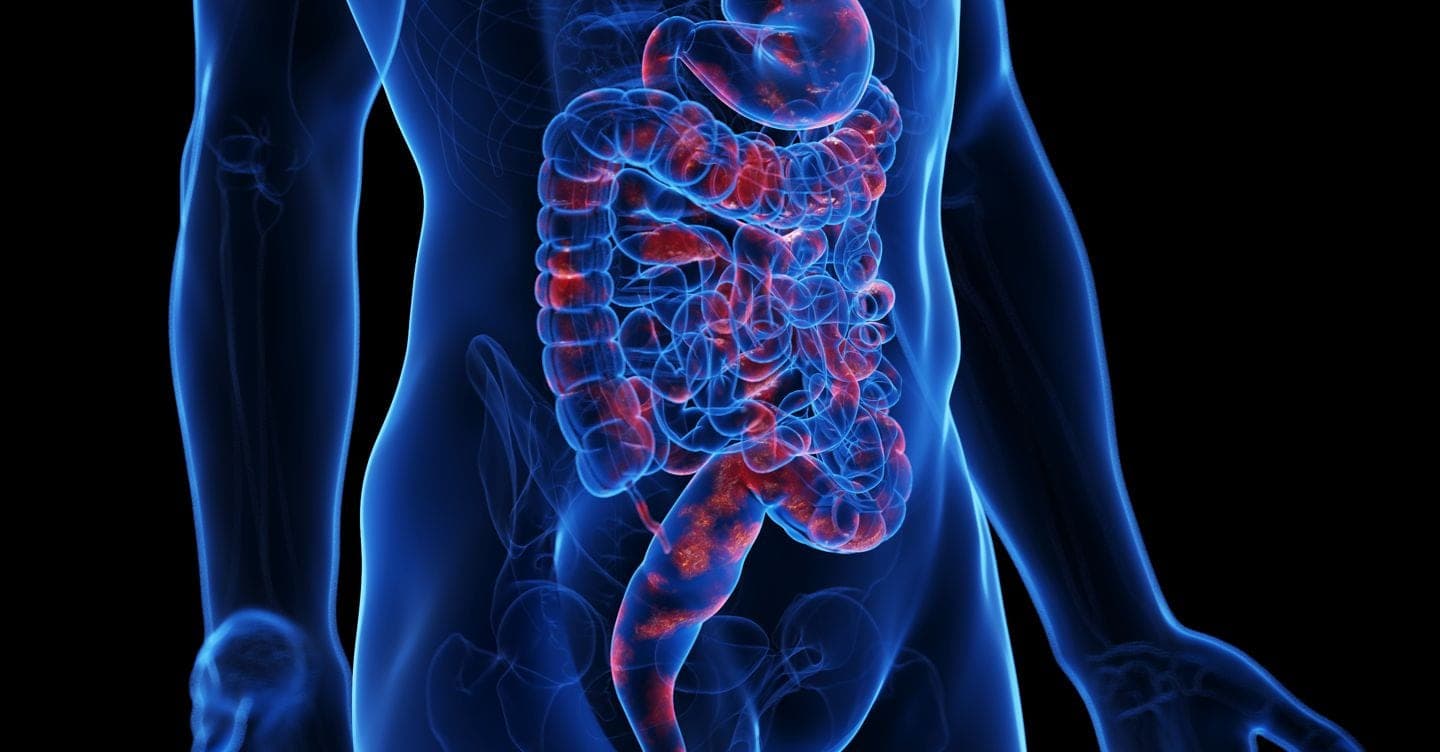 Se l’intestino si trasforma in una distilleria:  la sindrome da «auto-produzione di alcol»